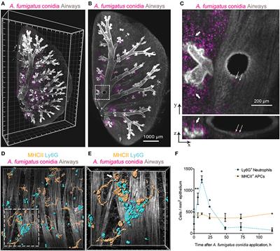 Murine Intraepithelial Dendritic Cells Interact With Phagocytic Cells During Aspergillus fumigatus-Induced Inflammation